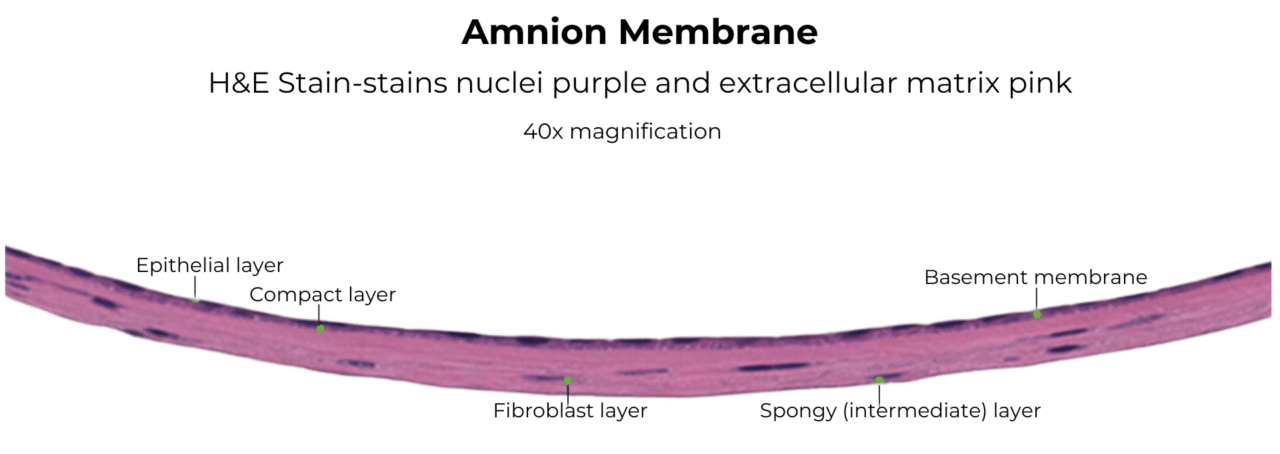 Amnion Membrane